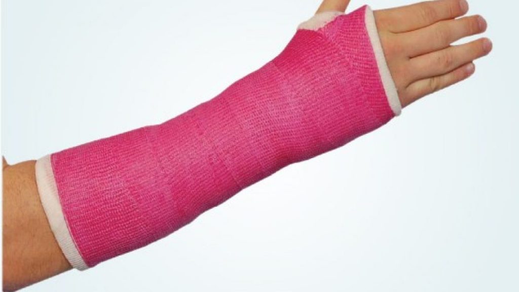 Casting and Splinting Products Market