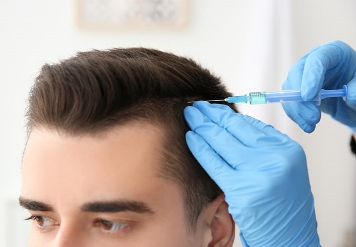 High Level of Stress and Hormonal Imbalance Expected to Drive Global Alopecia Treatment Market: Ken Research High Level of Stress and Hormonal Imbalance Expected to Drive Global Alopecia Treatment Market: Ken Research