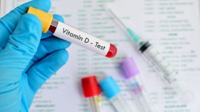 Global Vitamin D Testing Market