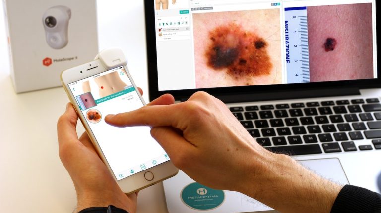 Global Tele dermatology