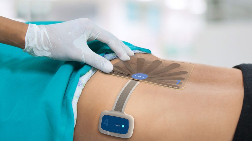 Global Wound Dressing Market