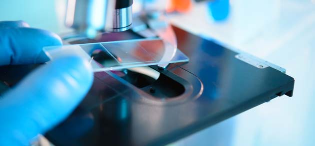 Infectious Disease Diagnostic Market Is Predicted to Augment Owing to Increase In Awareness Concerning Early Diagnosis: Ken Research