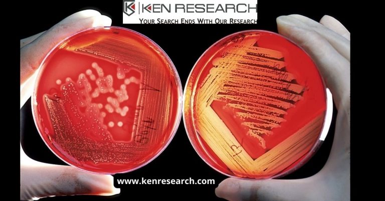 Europe Blood Culture Tests Market (1)