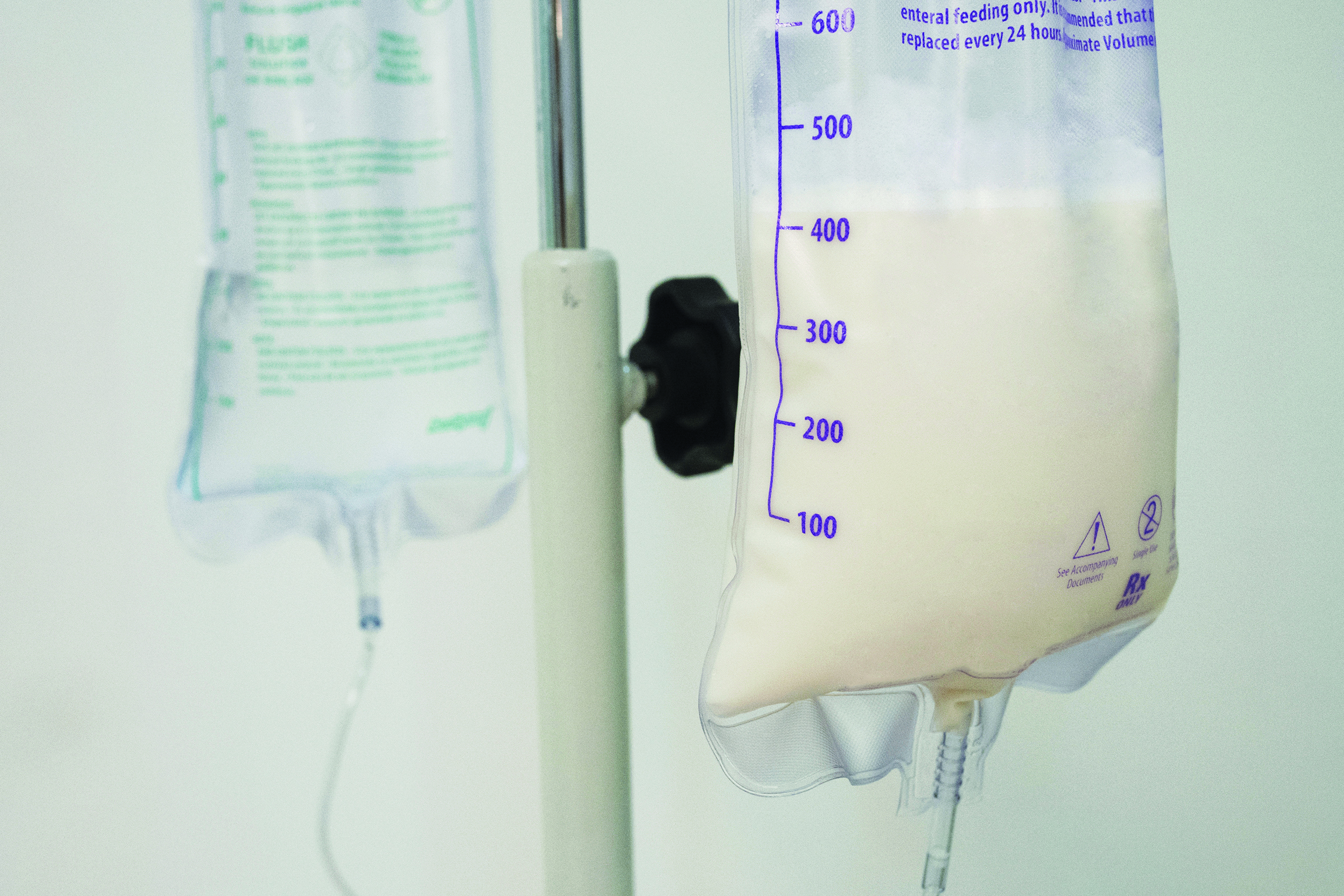 Europe Enteral Nutrition Market 2021 to 2030, Research Report, Size, Share, Demand, Growth, Covid-19 Impact, Industry Analysis, Future Outlook, and Major Players: Ken Research