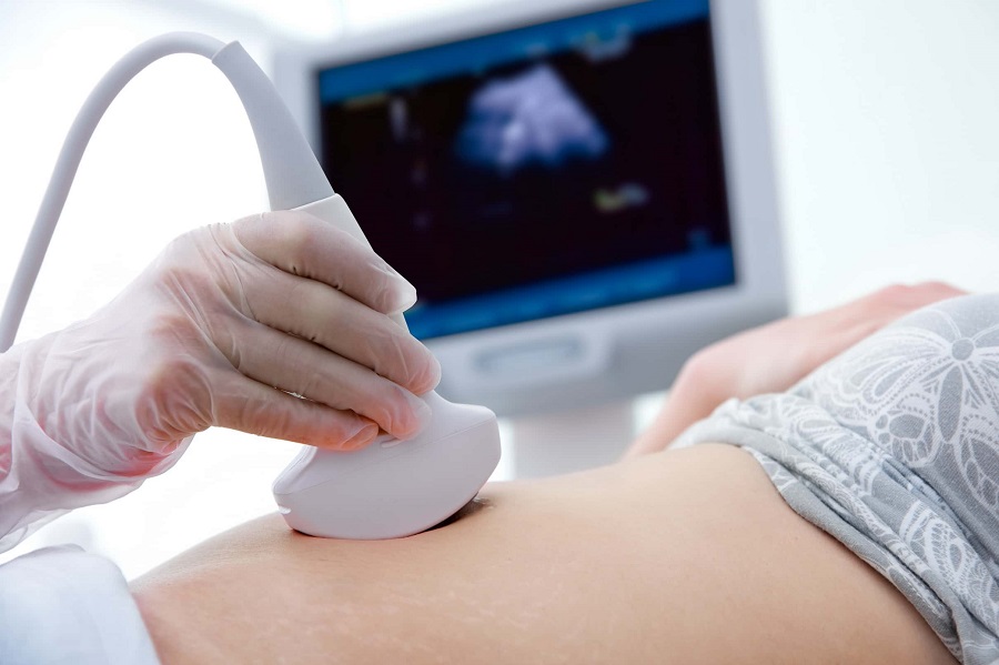 Global Color Ultrasound Market