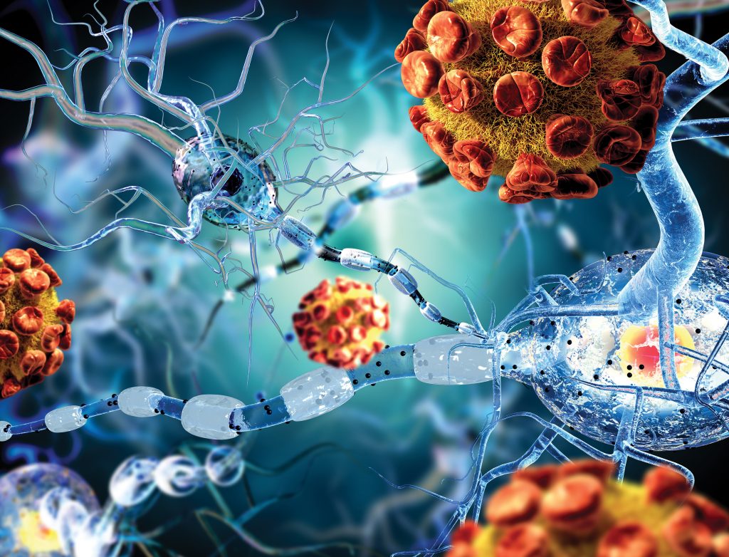 Europe Autoimmune Disease Diagnostics Market