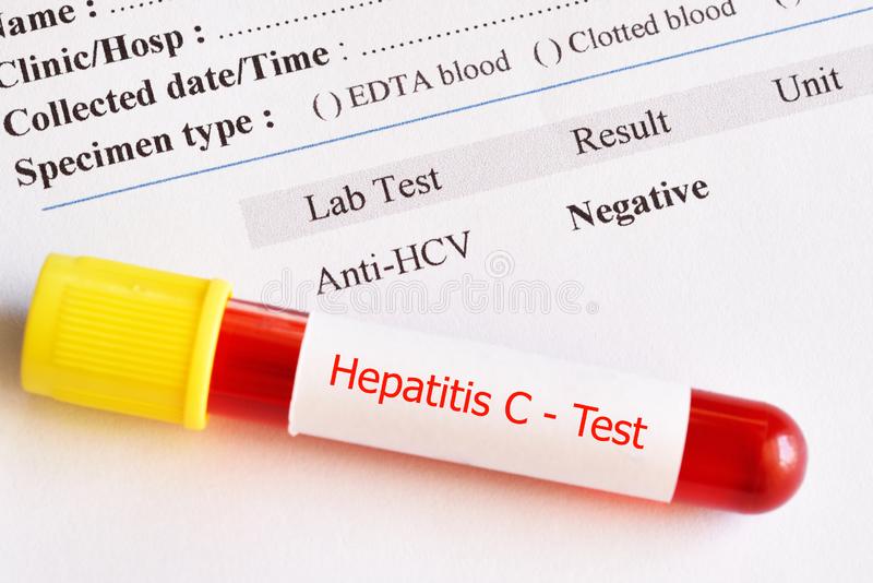 Global Hepatitis Diagnostic Test Market