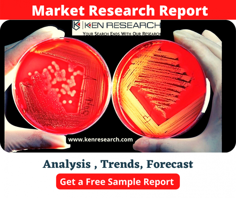 Europe Blood Culture Tests Market Growth Is Driven by Growing Investments In R&D Activities: Ken Research Europe Blood Culture Tests Market Growth Is Driven by Growing Investments In R&D Activities: Ken Research