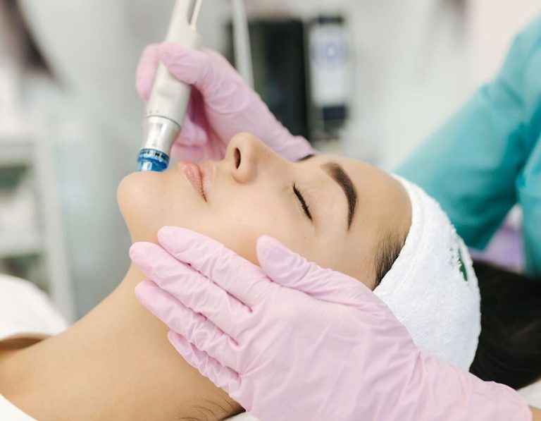 Aesthetic Laser Market